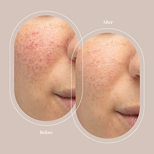 Серум със стволови клетки Trophy Skin Арган - Овлажняващ средство за борба с възрастта кожата с хиалуронова киселина